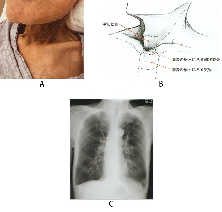 第120回 B問題 第42問の問題画像