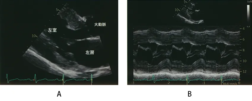 第120回 D問題 第44問の問題画像