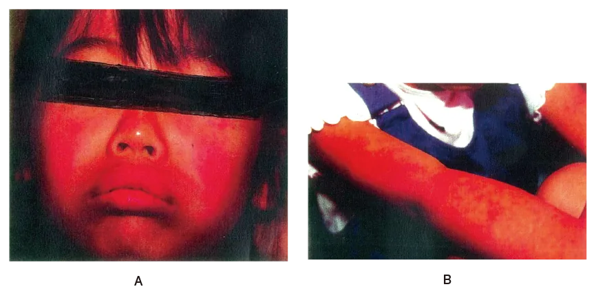 第99回 G問題 第54問の問題画像